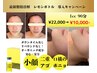 【口横のたるみor二重アゴ】レモンボトル　1cc 18,000→10,000
