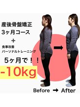 リノア(Linoa)/産後ママさんのビフォーアフター