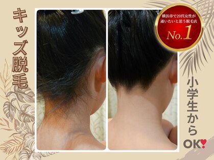 エステティックサロン キュビア(Cubia)の写真