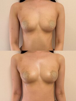 プリマベラ 大阪梅田(primabella)/スタンダードバスト+背面ケア