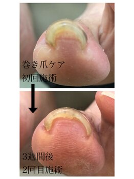 ルミエール アンド ニコ(Lumiere and nico)/