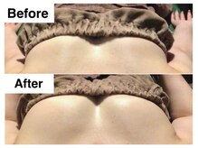 ナトゥーラ チュチュ(natura chuchu)/根本改善・サイズUP★梅田