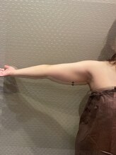 ビュウナ 銀座(BEAUNA)/脂肪冷却/frozen8