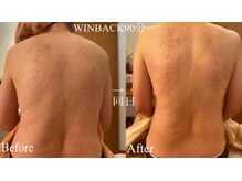 フセヤ &nbsp;エステティックアロマヨガスクール(FUSEYA)/WINBACK 脚　一宮/癒し