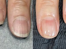 レジーナネイル(Reginanail)の雰囲気（自爪育成/鳳西町/マニキュア/ハンドケア/ケア/深爪/高石/育成/堺）