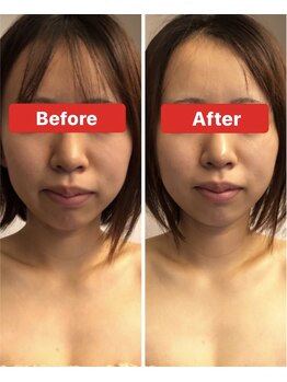 小顔コルギサロン シー(She)/【コルギ】1度の変化!