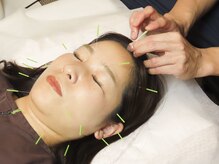 大塚ひりゅう鍼灸院/美容鍼