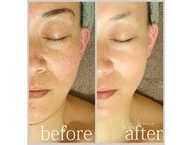 アン グレーヌ 自由が丘(unegraine)/整うキメ、うるおうツヤ肌