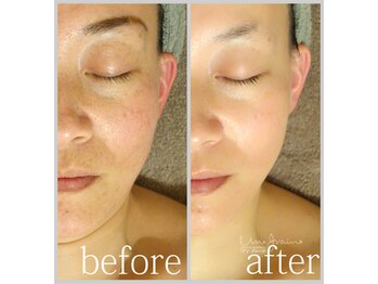 アン グレーヌ 自由が丘(unegraine)/整うキメ、うるおうツヤ肌