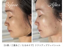 サラスヴァティー(SARASVATI)/引き締まった小顔に★30代女性