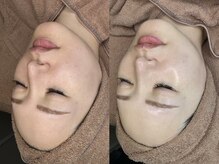 シャルマン(Charmant)/befoer、after