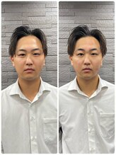 長寿鍼灸院 長寿整骨院/men's美容鍼50本効果★