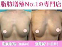 サラエクセレント 新宿(SARA EXCELLENT)/数回でもサイズアップ！