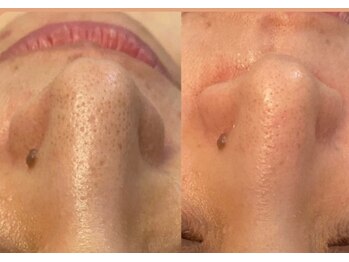 グラント ふじみ野店(grant)/