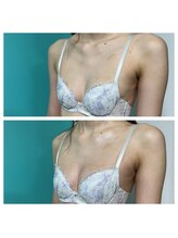 ネイト ワックス(Neit Wax)/巻き肩やストレートネックも改善