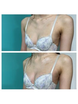 ネイト ワックス(Neit Wax)/巻き肩やストレートネックも改善