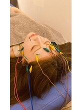 恵比寿駅前整骨院はり院 別館【美容鍼・鍼治療・整体】/美容鍼　小顔　リフトアップ　