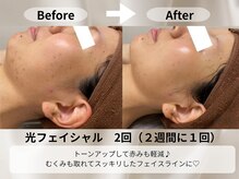 モア 星ヶ丘店(MORE)