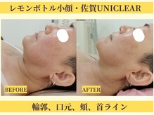 ユニクリア 佐賀(Uniclear)