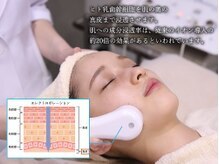 リンフェイス 浦安店(RINFACE)/エレクトロポレーション