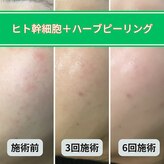 ヘアティブ アンド スキンベイビー 名古屋金山店(Hairtive&Skin Baby)