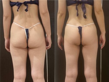 プリオール 前橋南店(Prior)/インド痩身