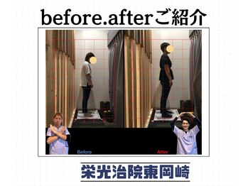 栄光治院 整体院東岡崎/頭が重たいって知ってましたか？