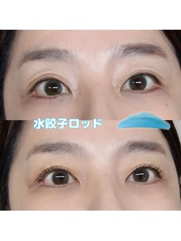 アトリエリン 小牧本店(Atelier Rin)/水餃子ロッド