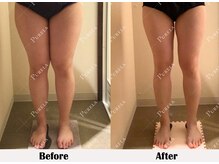 ピュアラ グランピュアラ難波店/ 脚ラインの変化が一目で！