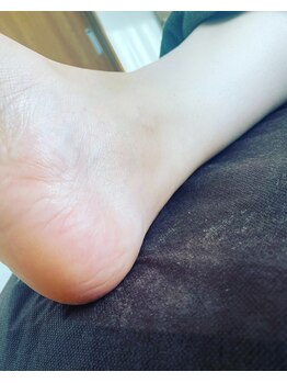 グリーングリーン(GREEN GREEN)/かかとのひび割れがふわふわに!