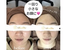 ブリリエット 天王寺店(Brilliet)の雰囲気（小顔はお任せください！女優さんのような小さなお顔へ導きます☆）