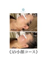 サロンドシェリ(salon de cheri)/小顔
