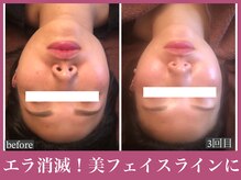 アクアビー(AQUA-B)/