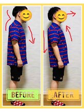 やくいん整骨院 薬院店/姿勢ビフォーアフター