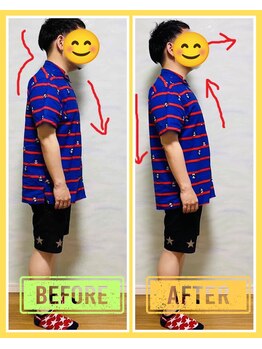 やくいん整骨院 薬院店/姿勢ビフォーアフター