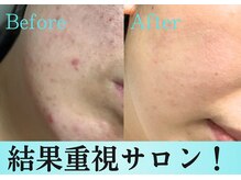 スリリアン 銀座