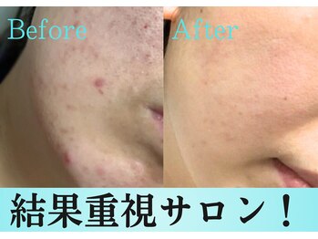 スリリアン 銀座