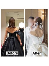 ライズ/お客様のビフォーアフター