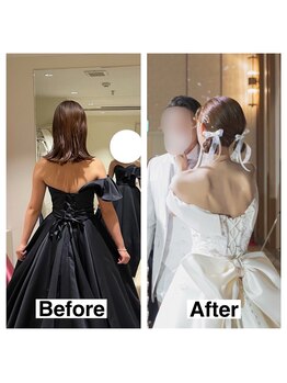 ライズ/お客様のビフォーアフター