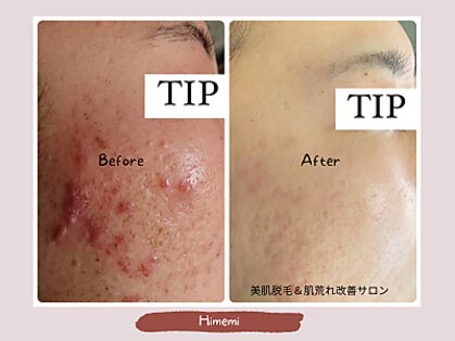 ヒメミ(Himemi)の写真