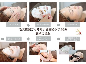 ローズフィールド(Rosefield)/毛穴撲滅ごっそり 施術の流れ