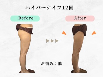 美容整体ウェリナ 中川八田院/小顔矯正/骨盤矯正/痩身整体