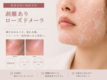 エープラス 日立(Aplus)/剥けるからこそ、変わる肌。