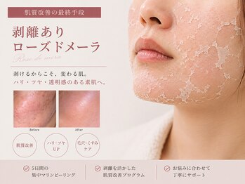 エープラス 日立(Aplus)/剥けるからこそ、変わる肌。