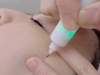 レナヴィスの写真/【シミケア専門】30～40代の方必見◎レナヴィスはシミにお悩みの方、肌質改善を目指す方の為のサロンです♪