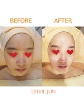 エステジュン(ESTHE JUN)/