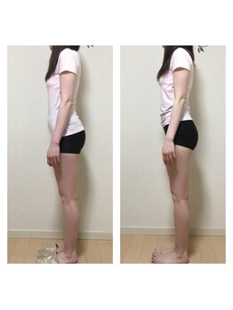 骨盤矯正サロン フロウ 大国町(FLOW)/骨盤矯正で反り腰も解消！