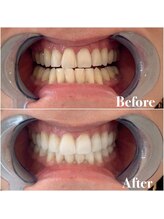 ライトビューティー 池袋店(LightBeauty)/症例写真