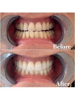 ライトビューティー 池袋店(LightBeauty)/症例写真