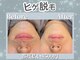 ラジター 江坂(LAZITER)の写真